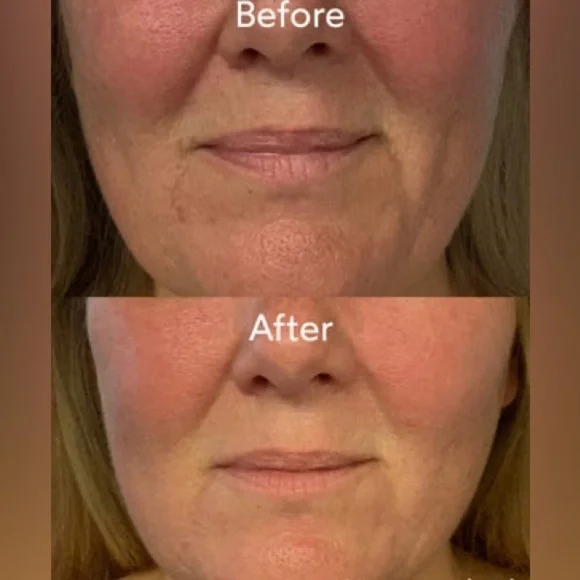 Nightly repair treatment - Picture 5 of 6